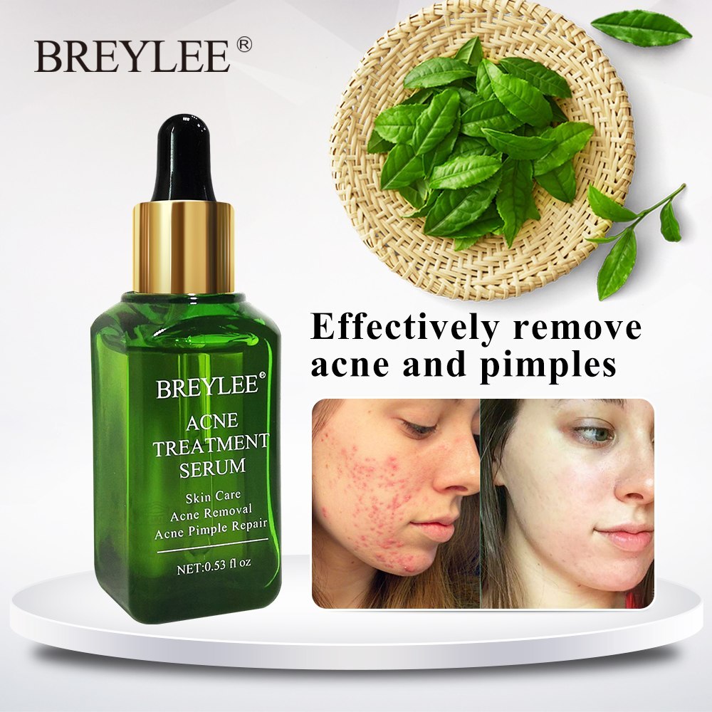 BREYLEE Acne Treatment Serum Face Facial Anti Acne Scar Removal