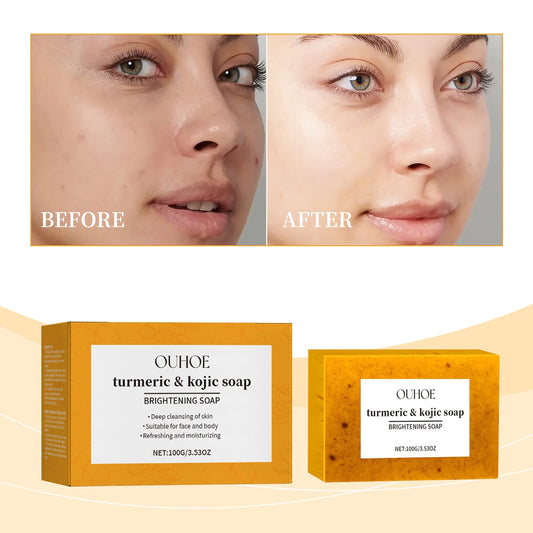 Lemon Turmeric Brightening Soap Gently Cleanses The Skin