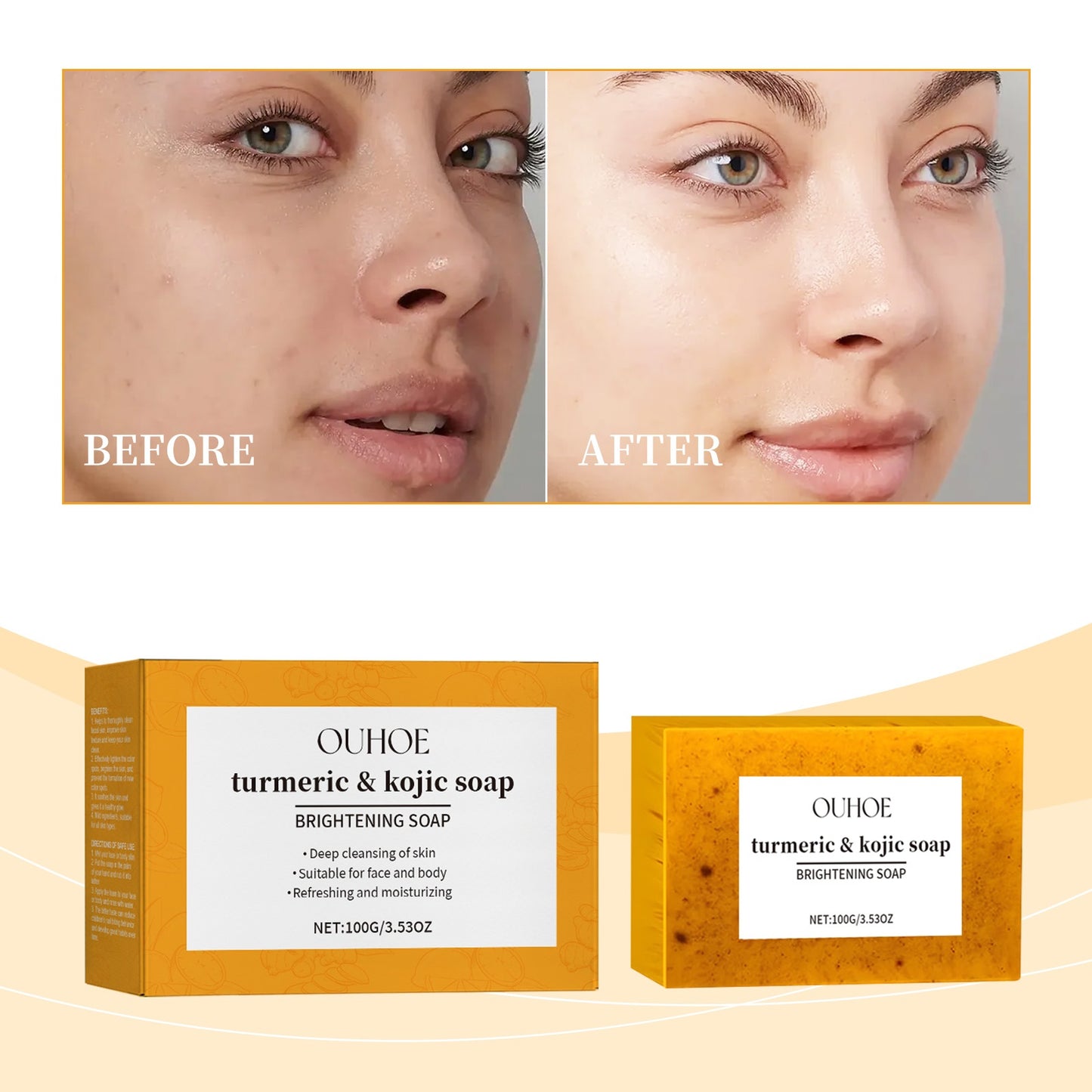 Lemon Turmeric Brightening Soap Gently Cleanses The Skin