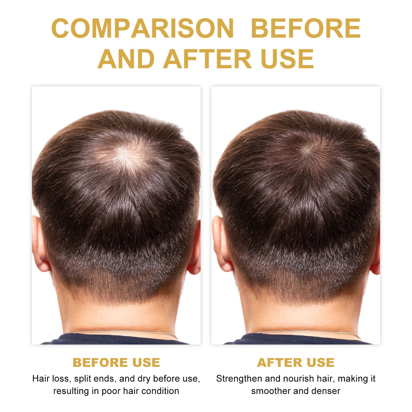 EELHOE Rosemary Hair Treatment Oil Scalp Cleansing Conditioning Volumizing Smoothing Repair