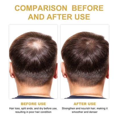 EELHOE Rosemary Hair Treatment Oil Scalp Cleansing Conditioning Volumizing Smoothing Repair